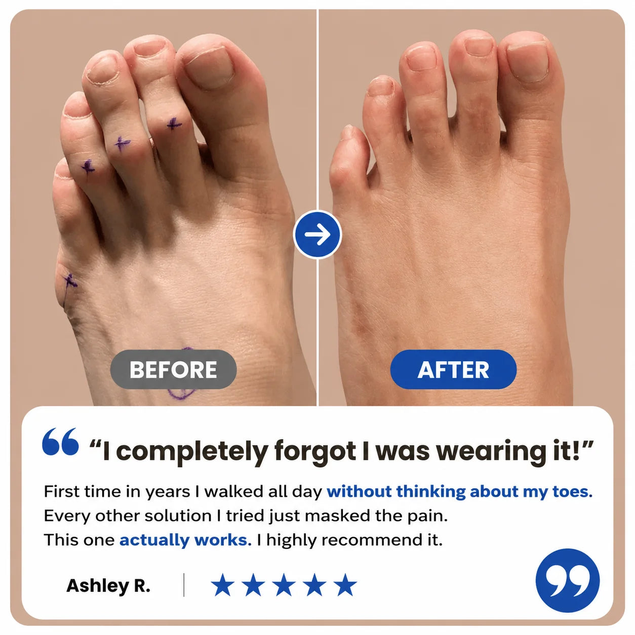 Hammer Toe Corrector