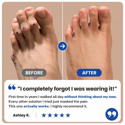 Hammer Toe Corrector